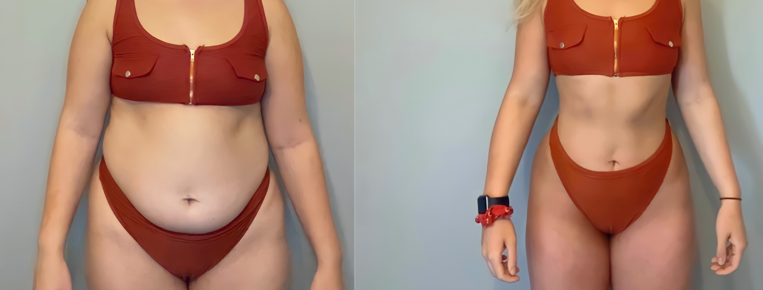 Before and after transformation